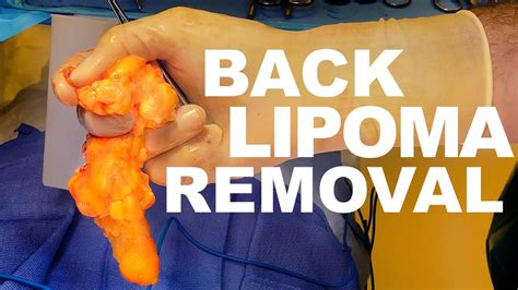 Bones are Unsafe for Your Dog, No Bones about It. . Signs of infection after lipoma removal